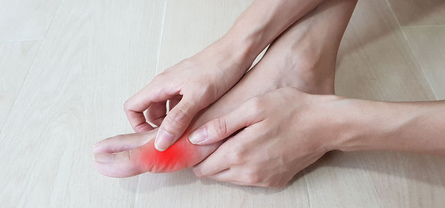 Gichtarthritis: Aktuelle Ansätze in der Diagnostik und Therapie